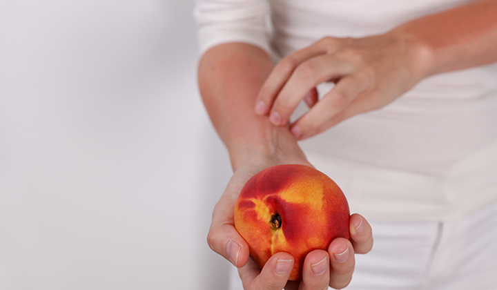 Hautausschlag durch Lebensmittel